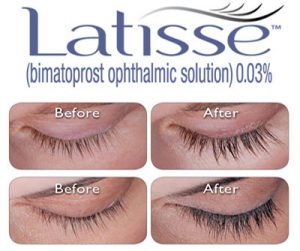 Latisse®